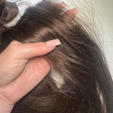 Extensions