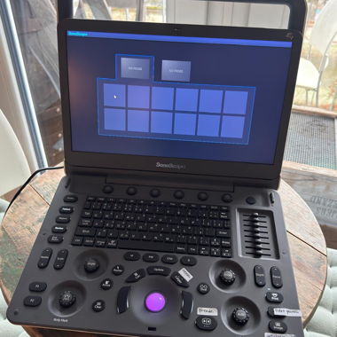 SonoScape E1 Ultrasound