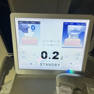 Hifu Ultrasound Device