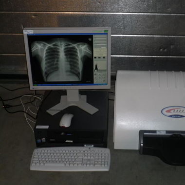 Kodak Orex PcCR 1417 ACL4 Digital X-ray