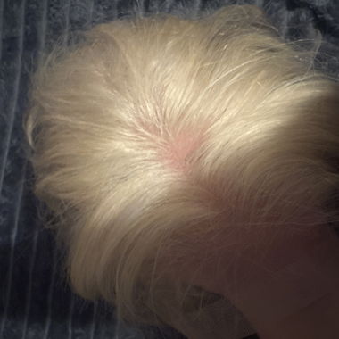 Vorderwasser parrucca capelli umani